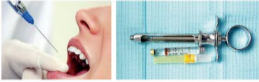 胰島素，牙科麻醉6.png
